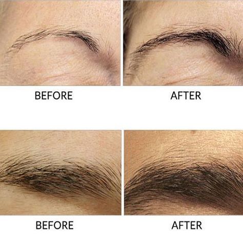 Results after using serum 💁🏽‍♀️ - #naturaleyebrows #california #face #eyebrowsgrowth #eyebrows #eyebrows serum Thinning Eyebrows, Thicker Eyebrows Naturally, Grow Eyebrows Thicker, Eyebrow Growth Serum, Eyebrow Serum, Hair Growth Secrets, Filling In Eyebrows, How To Grow Eyebrows, Eyebrow Growth