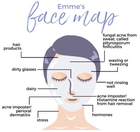 Pimple Face Mapping, Acne Chart, Pimple Face, Clear Skin Care, Pimples On Face, Face Mapping, Skin Tips, Cleanser And Toner, Skincare Set