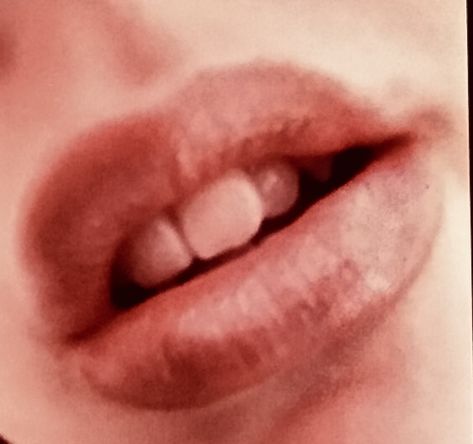 Dirty lip, MY LIPS Lips Aesthetic, Dry Cracked Lips, Cracked Lips, Chapped Lips, Lips