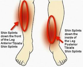 Shin Splints Stretches, Lower Leg Pain, Shin Splint Exercises, Diy Massage, Running Skirt, Tight Hip Flexors, Psoas Muscle, Shin Splints, Mobility Exercises