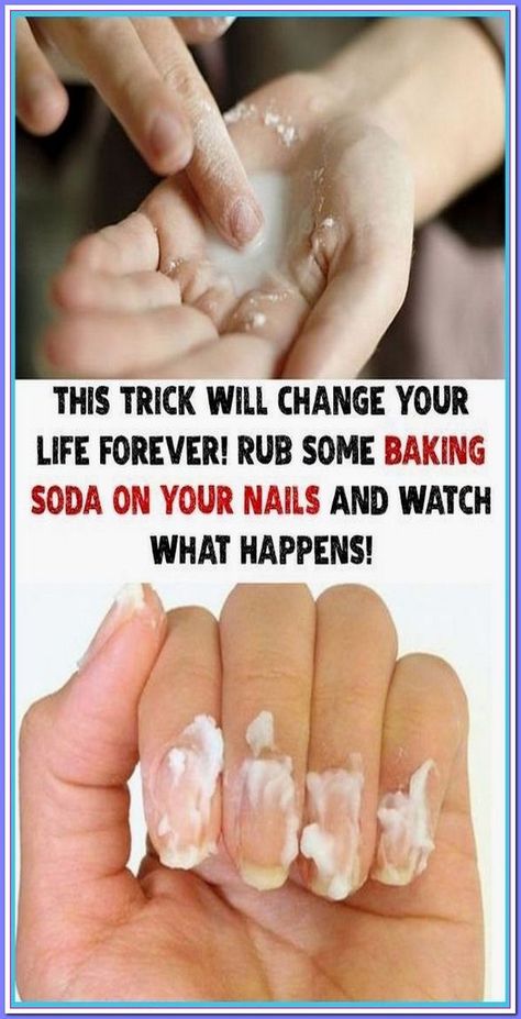 Rub Some Baking Soda on Your Nails and Watch What Happens. This Trick Will Change Your Life Forever! Baking Soda Nails, Baking Soda Body Scrub, Candida Yeast, Baking Soda Shampoo, Nail Fungus, Diy Health, Peppermint Essential Oil, Change Your Life, Healthy Tips