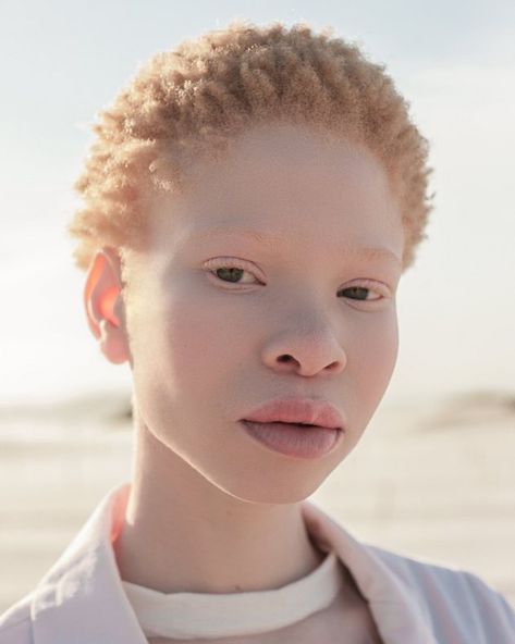 Albino Black People, Albino Model, Brown Girls Makeup, Face Study, Different Kinds Of Art, Art Photography Portrait, Face Reference, Human Poses Reference, We Are The World