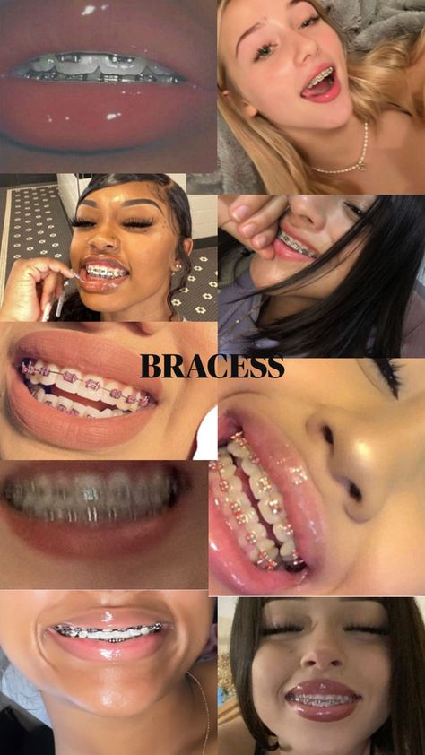 NOT MINE Braces For Dark Skin, Braces Colors Ideas Dark Skin, Brave Girl, You Are Beautiful, No Matter What, Braces, Not Mine, Matter, Skin