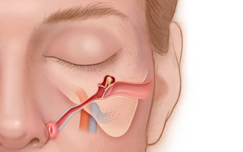 Eustachian tube dysfunction (ETD) and how to treat it Sinus Cleanse, Eustachian Tube Dysfunction, Ear Congestion, Ear Tubes, Soft Palate, Health Chart, Basic Anatomy And Physiology, Middle Ear, Ear Health