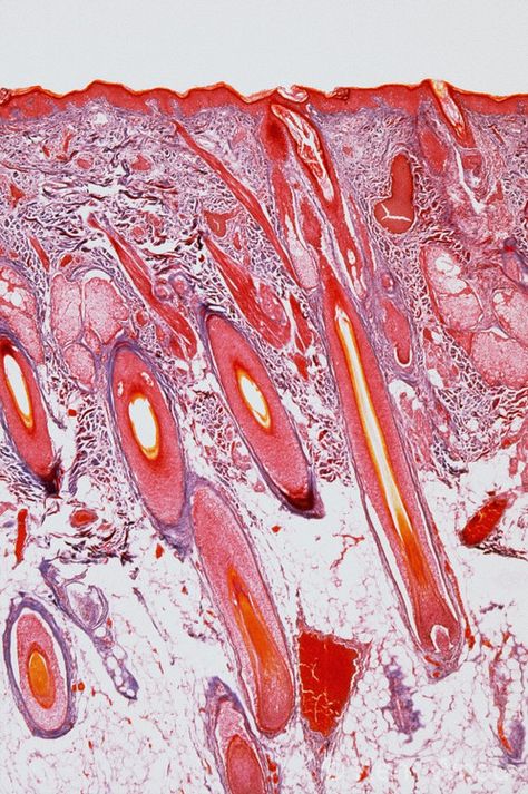 Skin under microscope. Pretty! Like marbled paper. Could we use microscopes in Dana Hall to look at a wide range of skins here at UB? Skin Under Microscope, Microscope Art, Human Cell, Under Microscope, 3d Anatomy, Microscopic Photography, Wood Photography, Microscopic Images, Tiger Skin