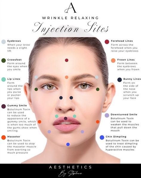 Face Injections, Botox Injection Sites, Injection Sites, Facial Aesthetic, Botox Wrinkles, Facial Injections, Botox Injection, Face Fillers, Facial Anatomy