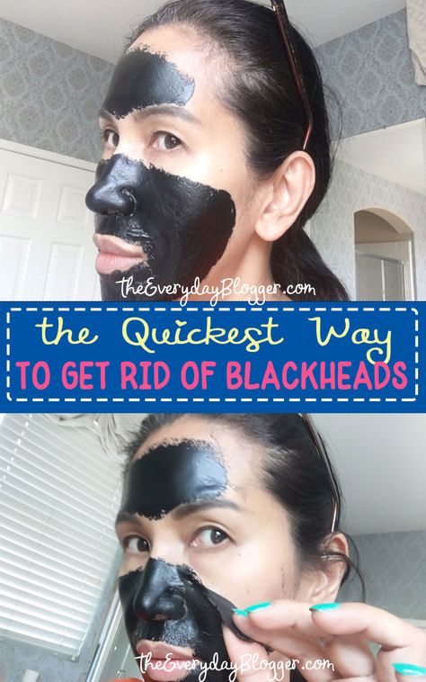 How to #GetRidofBlackheads on Nose - I can swear that this could be the best blackhead remover and the fact that I can make a way less expensive version that works just as well. Diy Pore Strips, Best Blackhead Remover, Blackhead Remover Diy, Blackheads On Nose, Rid Of Blackheads, Blackhead Mask, Pore Strips, Blackhead Removal, Spots On Face