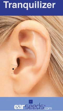 Earseed Chart, Earseed Placement, Ear Seeds Placement Chart, Auricular Therapy, Ear Acupressure Points, Ear Acupressure, Ear Reflexology, Ear Acupuncture, Ear Seeds