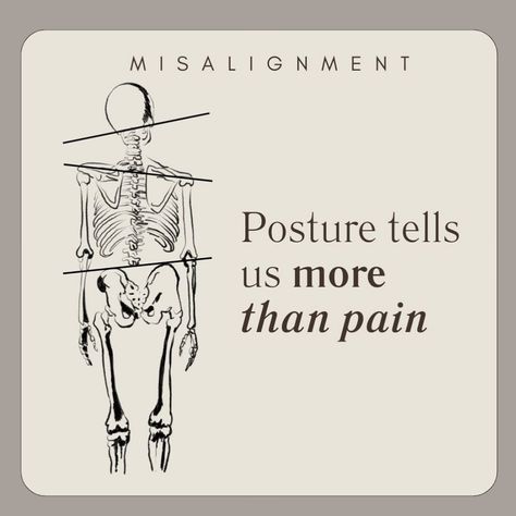 🌟SUBLUXATIONS WITH NO PAIN🌟 Did you know that you. An have spinal subluxations, also known as misalignments, and experience ZERO pain? Here are some of the reasons why this may be the case: 🌟Asymptomatic Misalignment: Spinal misalignments, also known as subluxations, don’t always cause pain or noticeable symptoms. The spine might be out of alignment, but the body might adapt to the misalignment without generating pain. 🌟Compensatory Mechanisms: The body often develops compensatory mechan...