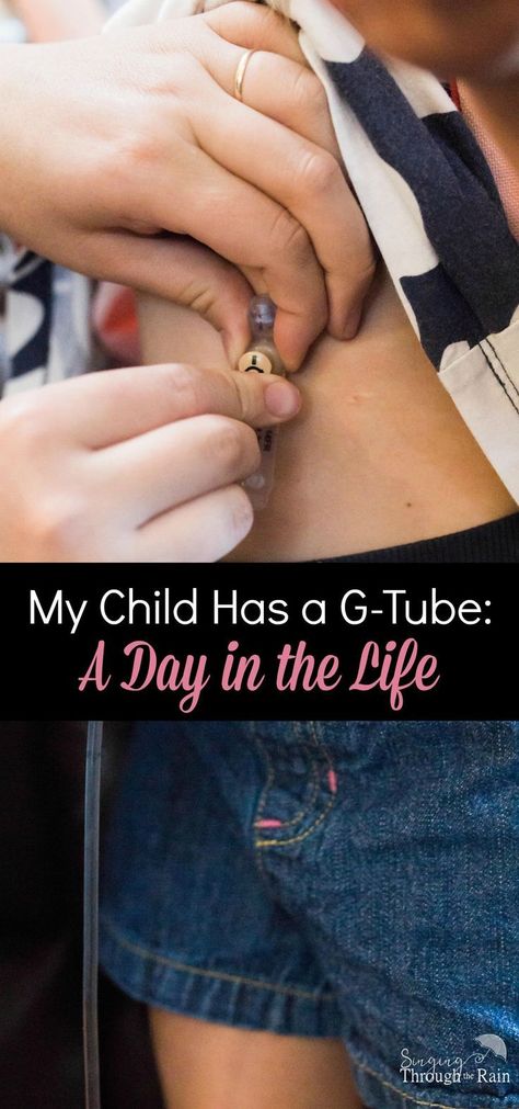 Feeding Tube Awareness, Child Life Specialist, Special Needs Mom, Working Mom Tips, Pediatric Therapy, Feeding Tube, Sensory Processing Disorder, Special Needs Kids, Play Based Learning