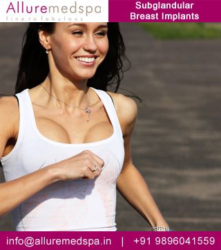 Breast Lift Surgery, Breast Surgery, Easy Yoga Workouts, Sport Body, Breast Lift, Breast Augmentation, Pilates Workout, Body Health, Healthy Body