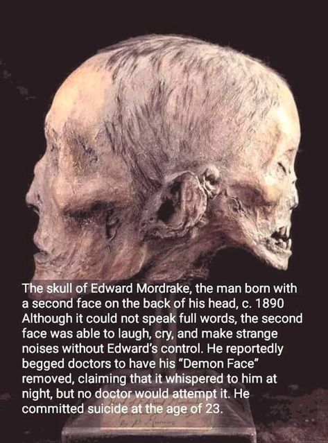 Dawn Phenomenon, Edward Mordrake, History Instagram, Scary Facts, Creepy Facts, Instagram Videos, Scary Stories, The More You Know, History Facts