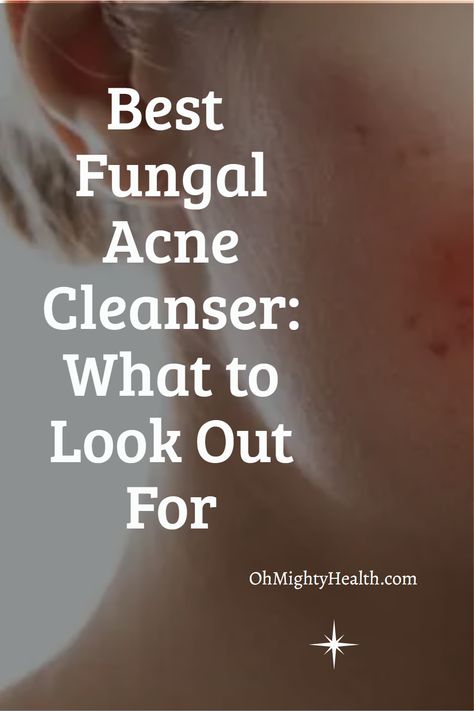 If you have fungal acne1 and are looking for the best fungal acne cleanser or face wash (different products!) you should read this first: cleansers tend to be more gentle and moisturizing than face washes, which usually contain surfactants (soap based ingredients) which lather and cleanse in a way that the natural oils can be stripped off very easily. I personally love face washes in the summer and more mild cleansers in the winter, but this is my own personal choice. Treat Fungal Acne, Diy Face Wash, Acne Cleanser, Fungal Acne, Natural Face Cleanser, Acne Vulgaris, Best Face Wash, Acne Face Wash, Natural Acne Remedies