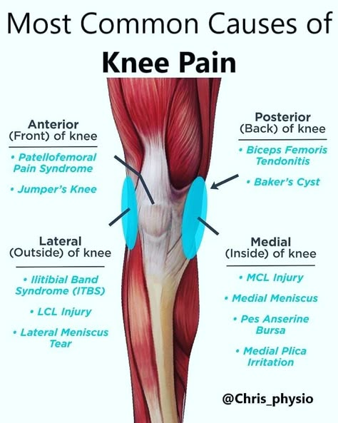 If you have knee pain maybe the photo will help you figure out what may be the cause. . . . . #physiotherapy #physio #rehab #acl… Knee Anatomy, Physical Therapy Assistant, Below The Knee Dress, Knee Pain Exercises, Knee Cap, Human Body Anatomy, Muscle Anatomy, Knee Exercises, Knee Pain Relief