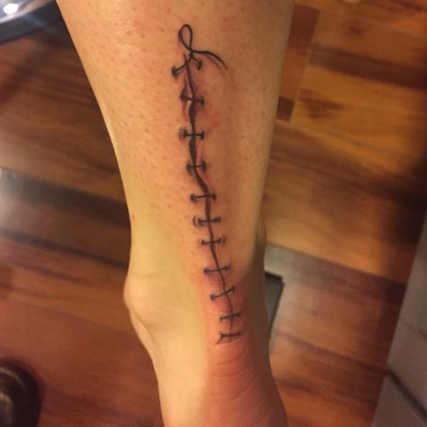 Suture Line Tattoo, Hyperrealism Tattoo, Port Scar Tattoo, Boss Tattoo, Character Tattoos, Tattoos To Cover Scars, Tattoo Time, Worlds Best Tattoos, Scar Tattoo