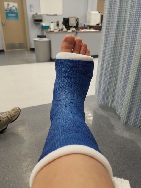 Sick Pictures In Hospital, Leg Surgery Snapchat, Broken Leg Snapchat Story, Leg Fracture Snap, Injured Leg Snap, Accident Pic Lag, Broke Leg Snapchat, Bandage Leg In Hospital, Broken Leg Cast