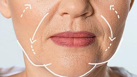 How To: Reduce Sagging Jowls (Do This) Jowls Makeup, Facial Exercises For Jowls, Mary Greenwell, Sagging Jowls, Sagging Cheeks, Thread Lift, Blue Eyeliner, Aesthetic Medicine, Facial Exercises