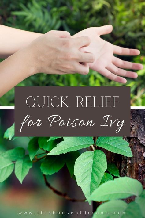 Poison Ivy On Skin, Poison Ivy Relief, Itching Remedies, Poison Ivy Plants, Poison Ivy Remedies, Poison Ivy Rash, Rashes Remedies, Soothing Face Mask, Poison Oak