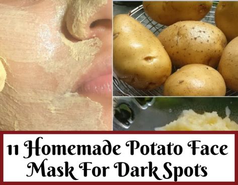 How To Use Potato For Dark Spots On Face Ovenight- Trabeauli Orange Peel Benefits, For Dark Spots On Face, Potato For Skin, Potato Face Mask, Turmeric Face Pack, Spot Remover For Face, Dark Spot Remover For Face, Potato Face, Benefits Of Potatoes