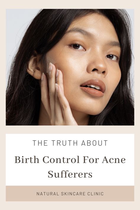 At the Natural Acne Clinic, we educate our patients about everything, including birth control and everything around it. Birth control pills, IUDs, implants, and shots are widely used today and prescribed often as a means to control acne. Most forms of birth control can have the potential to cause acne and weight gain in those susceptible. Acne Photos, Types Of Birth Control, Forms Of Birth Control, Natural Acne, Birth Control Pills, Hormonal Acne, Clear Acne, Online Programs, Skincare Tips