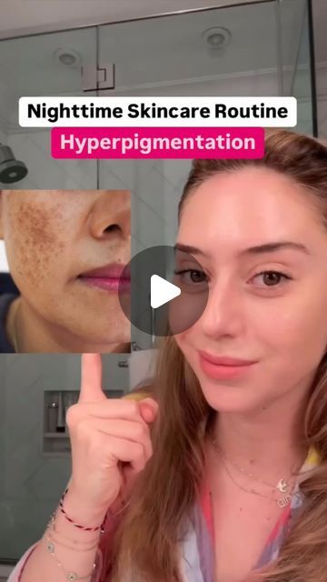 Dr. Shereene Idriss on Instagram: "How to treat discoloration: Ultimate Nighttime Routine 🔥  📚 For treating hyperpigmentation, your at home routine is essential and consistency is key! Here’s how to get the best results:  1️⃣ Prescription Hydroquinone: The gold standard for melasma and dark spots. Use it **cyclically** under dermatologist supervision to avoid skin tolerance and long-term side effects.   2️⃣ Key OTC Actives: DO NOT UNDERESTIMATE these as they support Hydroquinone, but more importantly continue to calm down pigment when you’re off hydroquinone:   - Vitamin C: Brightens and reduces dark spots by neutralizing free radicals.  - Niacinamide: Calms inflammation and helps prevent further pigmentation.  - Kojic Acid: Inhibits melanin production and works as a powerful skin-bright Hydroquinone 4% Before And After, Shereene Idriss, At Home Routine, Hyperpigmentation Mask, Home Routine, Treating Hyperpigmentation, Face Glow, Night Time Skin Care Routine, Nighttime Routine