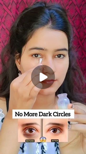 Darkcircles Remedies Under Eyes, How To Remove Dark Circles Under Eyes, Diy Under Eye Cream, Dark Circles Under The Eyes Remedies, Eye Dark Circles, Dark Circle Remedies, Under Eye Cream, Eye Wrinkles, Remove Dark Circles