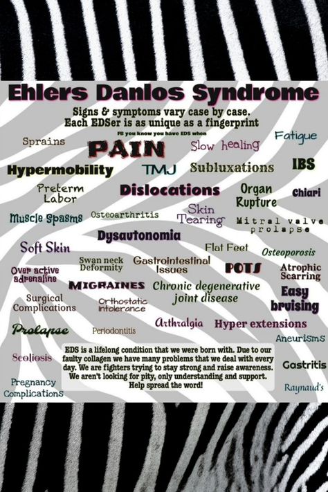 Ehlers Danlos Syndrome Symptoms, Elhers Danlos Syndrome, Connective Tissue Disorder, Ehlers Danlos Syndrome Hypermobility, Ehlers Danlos Syndrome Awareness, Mast Cell Activation Syndrome, Connective Tissue, Ehlers Danlos, Knee Pain Relief