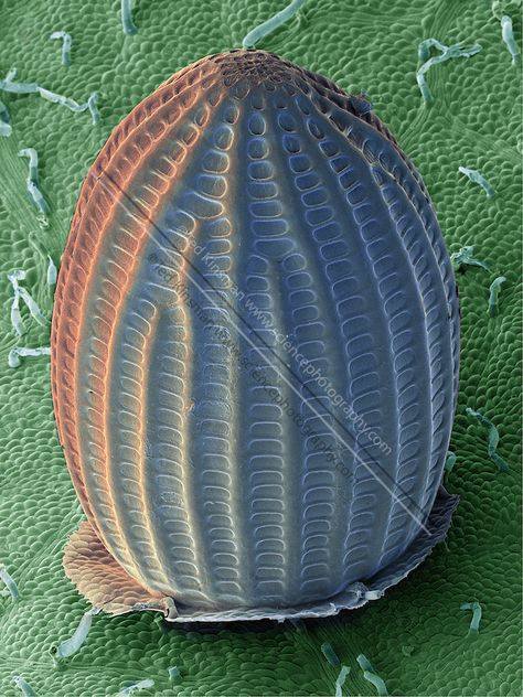 SEM a Monarch Butterfly Egg (Danaus plexippus). aid on the underside of a common milkweed leaf (Asclepias syriaca). The milkweed plant serves as the primary food source for monarch butterflies as well as a host for the monarchs eggs and larvae. This images was collected at 50x and represents a field of view .5mm wide. Butterfly Eggs, Science Photography, Insect Eggs, Electron Microscope Images, Scanning Electron Microscope, Eggs Image, Science Images, Microscopic Photography, Milkweed Plant