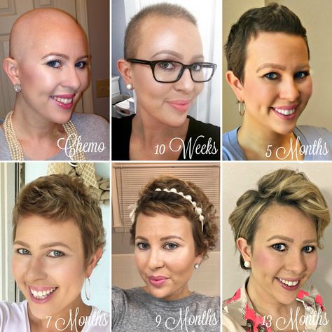 Hairstyles After Chemo, 1 Year Hair Growth, Chemo Curls, Hair Growth Stages, Hair Growth After Chemo, Chemo Hair, Wavy Haircuts, Hair Due, Super Hair