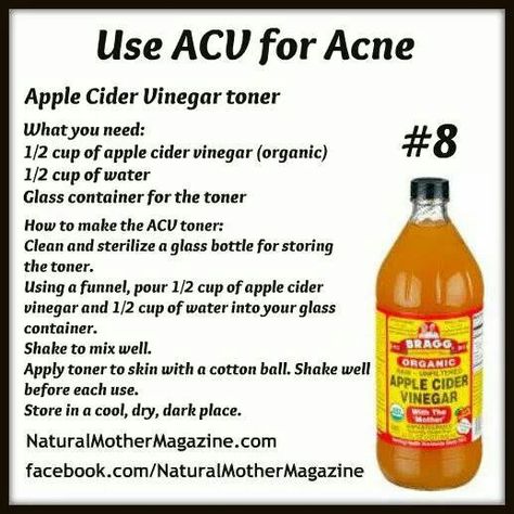 ACV facial toner Acv For Acne, Apple Cider Vinegar Toner, Apple Cider Vinegar Acne, Apple Cider Vinegar Uses, Apple Cider Vinegar For Skin, Apple Cider Benefits, Skin Remedies, Skin Care Remedies, Skin Care Recipes