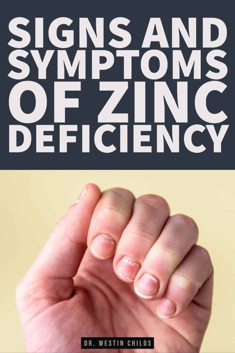 Understanding Zinc Deficiency and Sub-Optimal Zinc Levels https://youtu.be/BX3eT2UZR-s Zinc is considered an essential mineral for the body. This means that you cannot live without zinc, it is ESSENTIAL or REQUIRED for life! This means that | Zinc Deficiency Symptoms, Nerve Pain Remedies, Natural Thyroid Remedies, Zinc Benefits, Low Thyroid Remedies, Thyroid Remedies, Thyroid Supplements, Zinc Rich Foods, Deficiency Symptoms Zinc Deficiency Symptoms, Natural Thyroid Remedies, Low Thyroid Remedies, Zinc Benefits, Nerve Pain Remedies, Thyroid Remedies, Thyroid Supplements, Zinc Rich Foods, Deficiency Symptoms