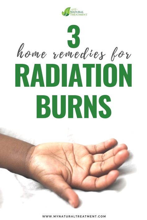 3 Home Remedies for Radiation Burn with Simple Herbs #radiationburn #radiationremedies Burn Cream, Radiation Burn, Burn Care, What To Use, Skin Remedies, Natural Treatments, Skin Problems, Skin Health, Natural Skin