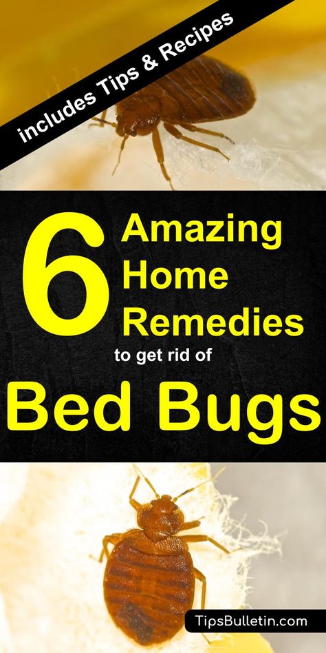 Have bed bugs? Want to keep them from living in your home without spending a fortune on an exterminator? Check out these quick home remedies for bed bugs. Bed Bug Remedies, Get Rid Of Bed Bugs, Kill Bed Bugs, Rid Of Bed Bugs, Bed Bug, Deep Cleaning Tips, Baking Soda Uses, Baking Soda Shampoo, Bed Bugs