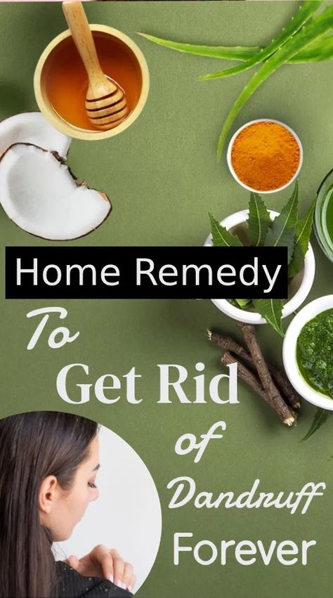 Dandruff Home Remedies, Aloe Vera For Sunburn, Dandruff Solutions, Home Remedies For Dandruff, Rid Of Dandruff, Home Remedies For Allergies, Fresh Aloe Vera Gel, Dry Skincare, Dandruff Remedy