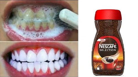 Baking Soda Teeth, Natural Teeth Whitening Diy, Natural Teeth Whitening Remedies, Alcohol Free Mouthwash, Tartar Removal, Teeth Whitening Homemade, Teeth Whitening Remedies, Teeth Whitening Diy, Teeth Bleaching