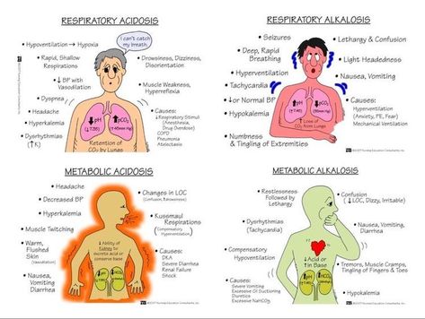 Metabolic Acidosis and Alkalosis Metabolic Alkalosis Nursing, Metabolic Acidosis Nursing, Metabolic Acidosis Vs Alkalosis Nursing, Metabolic Acidosis Mnemonic, Respiratory Acidosis Nursing, Acidosis Vs Alkalosis Cheat Sheets, Alkalosis Vs Acidosis Nursing, Respiratory Acidosis Vs Alkalosis, Hypoxia Vs Hypoxemia