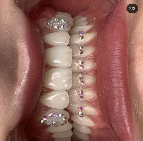 Gems On Teeth, Tooth Piercing, Tooth Gems Aesthetic, Teeth Bling, Tooth Jewel, Teeth Jewels, Tooth Gem Ideas, Tooth Gems Ideas, Teeth Gems