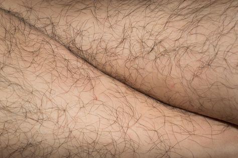 Excessive or unwanted hair in women: Causes and natural treatments Body Hair Positivity, Natural Hair Removal Remedies, Vellus Hair, Diet Changes, Unwanted Hair Growth, Underarm Odor, Lima Bean, Laser Clinics, Baileys Irish