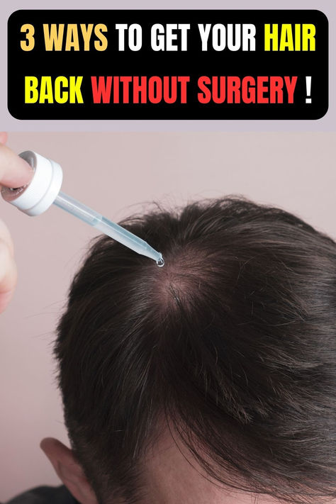 Common remedies that may help to stop balding include good hair care practices, rosemary oil, scalp massages, and stress management #hair #balding #hairloss #regrowhair #losthair #hairthinning Regrow Hairline, Hair Growth Men, How To Regrow Hair, Regrow Hair Naturally, Hair Growth For Men, Face Pores, Hair Nutrition, Thicker Fuller Hair, Hair Remedies For Growth