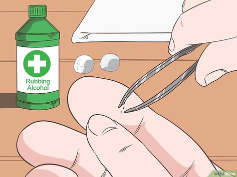 The Best Ways to Remove a Deep Splinter - wikiHow Remove Splinter From Hand, How To Remove Slivers, How To Remove Splinters From Hand, How To Get A Splinter Out Of Your Finger, How To Remove Splinter, How To Get A Splinter Out, Ice On Skin, Getting Splinters Out, Sliver Removal