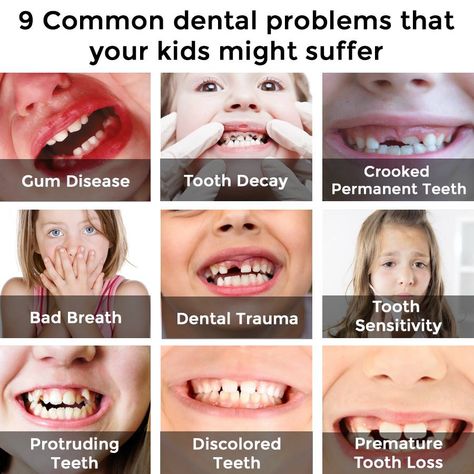 Sedation Dentistry, Kids Teeth, Pediatric Dental, Restorative Dentistry, Dental Kids, Pediatric Dentist, Pediatric Dentistry, Dental Problems, Dental Services