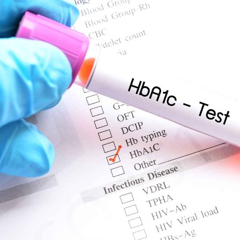 Hba1c Test, Insulin Therapy, A1c Levels, Blood Test Results, Physical Inactivity, Glucose Test, Low Blood Sugar Levels, Blood Groups, Blood Sugar Management