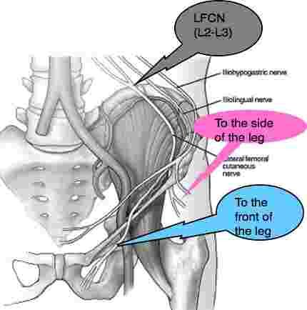 Maignes syndrome comes from thoraco lumbar region to the side of thigh and groin too. Maignes Syndrome, Middle Back Pain, Hip Problems, Upper Back Pain, Sciatica Pain, Neck And Back Pain, Leg Pain, Back Pain Exercises, Hip Pain