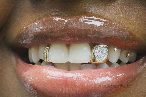 Girls With Grills, Girl Grillz, Grillz Teeth, Looks Hip Hop, Diamond Grillz, Maquillage On Fleek, Gold Grillz, Grills Teeth, Tooth Gem