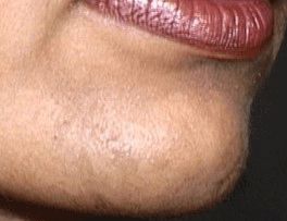 How to Get Rid of Female Chin Hair. Women typically have little hair on their faces, apart from eyebrows and the vellus hair that covers most of their... Chin Hair Removal, Vellus Hair, Makeup Jobs, Chin Hair, Sparse Eyebrows, Hair Removal Diy, Beauty Routine Checklist, Best Hair Removal Products, Remove Hair