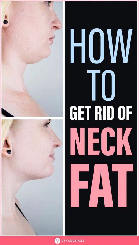 #ToRemoveUnwantedHair Neck Fat Exercises, Finding Hobbies, Garlic Health, Everyday Makeup Looks, Double Chin Exercises, Chin Exercises, Fat Burning Tea, Homemade Facial Mask, Face Fat