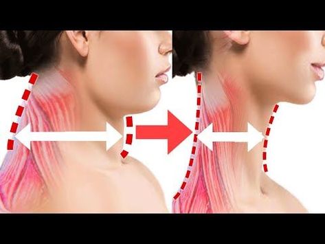 Slim Neck And Shoulders Exercise, Exercise For Neck Double Chin, How To Slim Neck And Face, How To Slim Your Face And Neck, How To Make My Neck Thinner, Neck Slim Exercise, Back Neck Exercises, Tall Neck Exercise, Neck Fat Loss Exercise