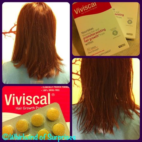 Prevent hair loss and treat thinning hair with Viviscal + Giveaway! Viviscal Before And After, Treat Thinning Hair, Lifestyle Health, Skincare Review, Thinning Hair, Food Cooking, Natural Supplements, Beauty Skincare, Travel Food