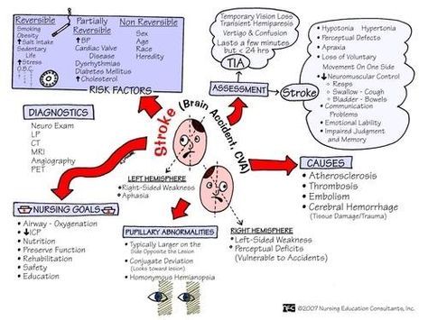 Stroke Nursing Neuro, Respiratory Problems, Med Surg Nursing, Nursing Mnemonics, Cardiac Nursing, Nurse Rock, Nursing School Studying, Med Surg, Nursing School Notes