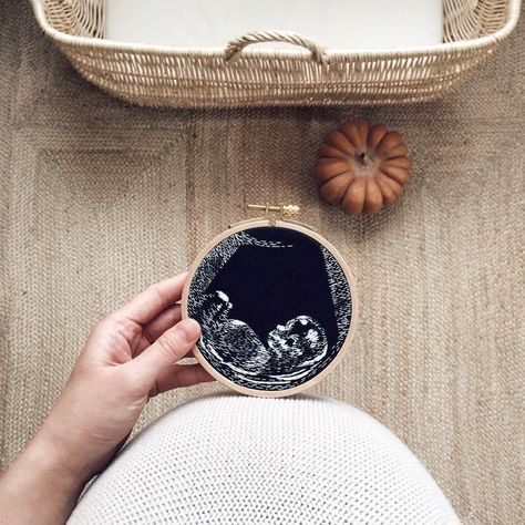 Ultrasound Embroidery, Baby Ultrasound, X Stitch, Contemporary Embroidery, Embroidery Inspiration, Modern Cross Stitch, Hoop Art, Ultrasound, Too Cute